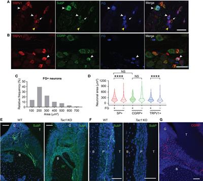 Substance P aggravates ligature-induced periodontitis in mice